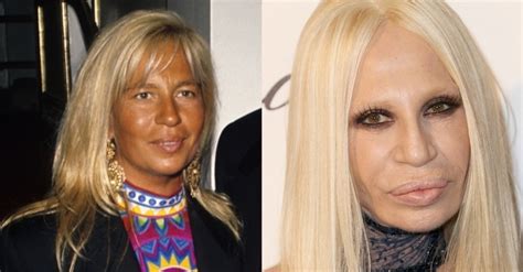 dona da versace antes e depois|donatella versace black dress.